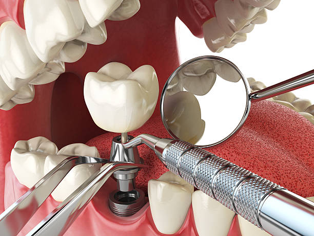 Best Emergency Gum Pain Relief  in Salinas, CA